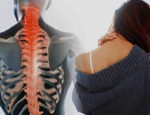 Uzmanında boyun fıtığı ile ilgili ihtar geldi: Cerrahi operasyon gerekebilir!