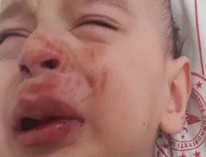 Ankara’da sokak köpeği dehşeti: Baba ve bir yaşındaki oğlu feci biçimde yarandı!