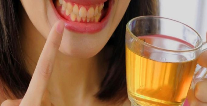 Çay yüzünden sararan dişlere tahlil: Diş lekeleri nasıl geçer, çay ve kahve dişlere ziyanlı mı?