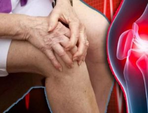 Menisküs nedir, nasıl geçer? Menisküs yırtığı belirtisi ve tedavisi nedir?